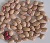 Round light speckled kidney beans