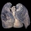 Double lungs and heart