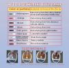 Sell Detox Foot Spa Purifier